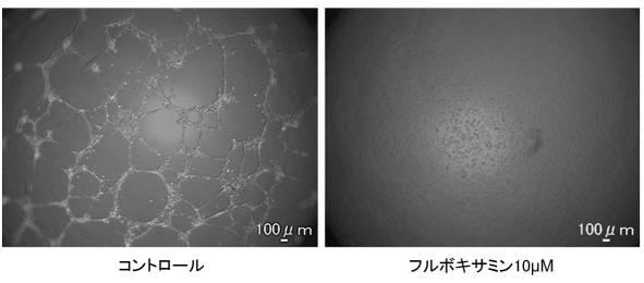 6952980-血管新生阻害薬 図000005