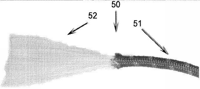 5763535-幹細胞または他の生理活性材料が組み込まれた外科手術用縫合糸 図000006