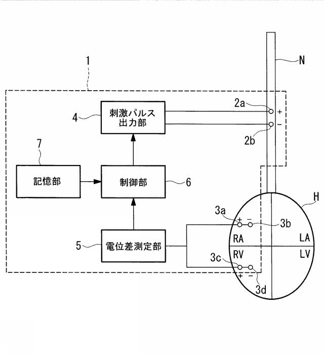 5775678-神経刺激装置 図000006