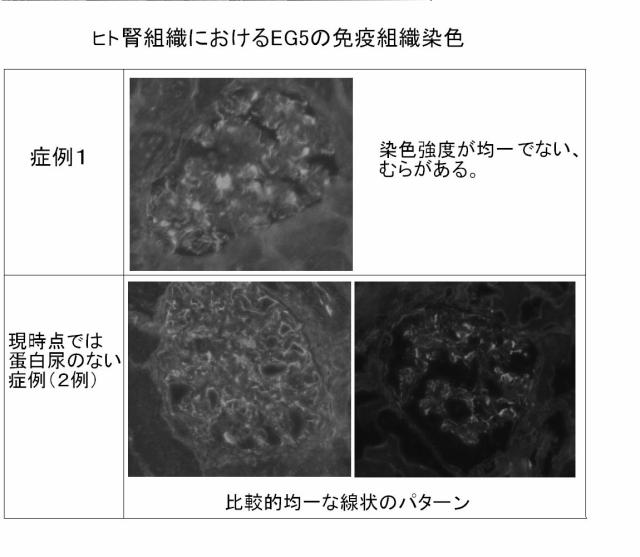 5830329-腎障害の新規マーカー 図000006