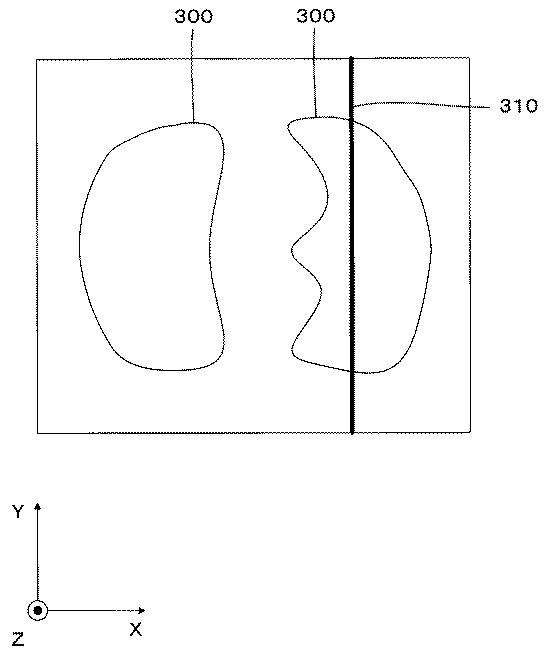 5835881-医用画像処理装置、及び医用画像処理プログラム 図000006