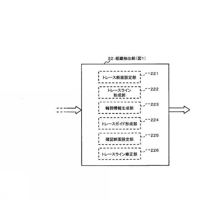 5841771-超音波データ処理装置 図000006