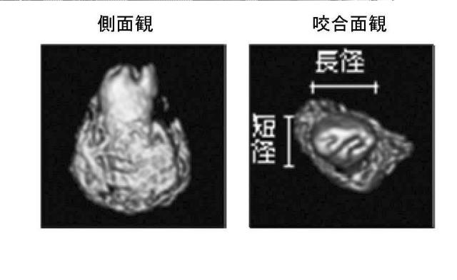 5868844-再生歯ユニットの製造方法 図000006