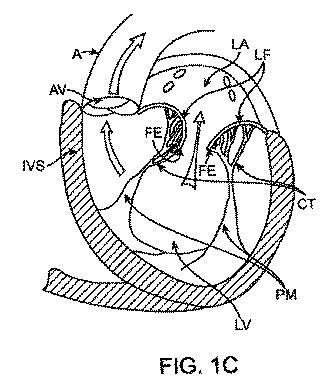 5872692-人工治療装置 図000006