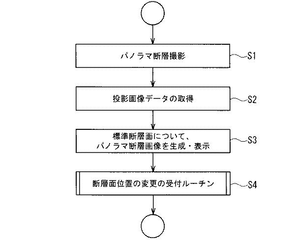 5881192-パノラマＸ線撮影装置及びパノラマＸ線撮影方法 図000006