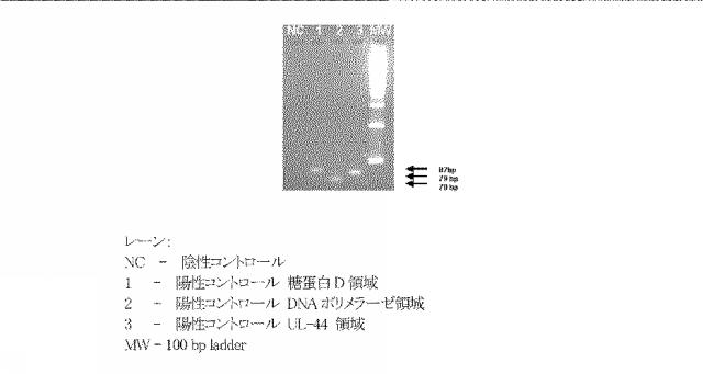 5927243-眼および中枢神経系の細菌、真菌、寄生虫およびウイルス感染の同時検出と識別のための新規な方法 図000006