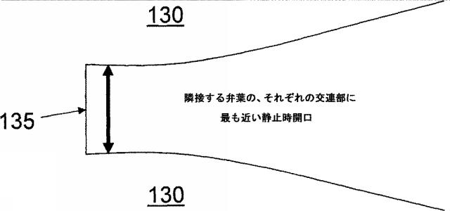 6038018-流れに最適化したポリマー心臓弁 図000006