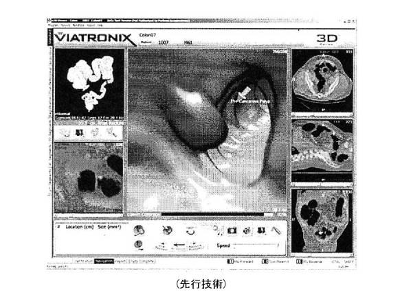 6396310-第一レンダリング投影と第二レンダリング投影との間のトランジションをユーザーに表示するための方法および装置 図000006