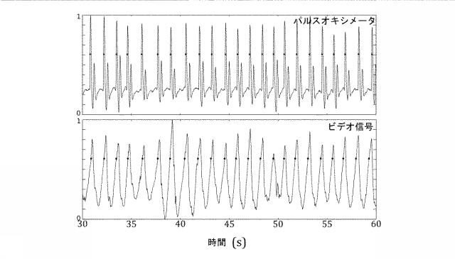 6426201-同時磁気共鳴イメージング中の非接触式生理学的モニタリング 図000006