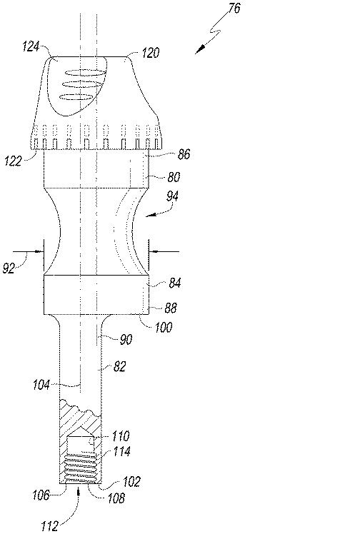 6433665-オフセットを設定するための脛骨の整形外科用手術器具 図000006