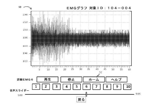 6505708-データ統合インターフェースならびに筋電図記録データおよび音声データを検討する方法 図000006