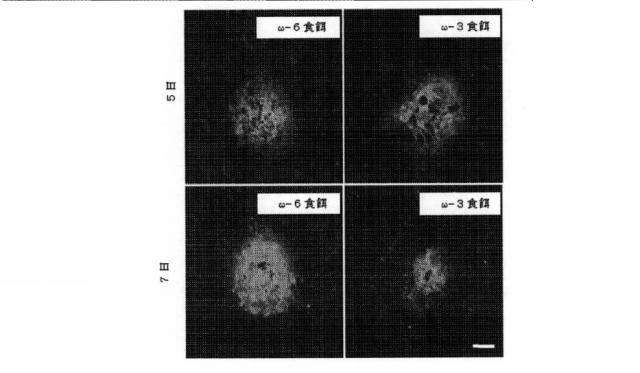 6526570-炎症及び血管形成を減少させるＣＹＰ４５０脂質メタボライト 図000006