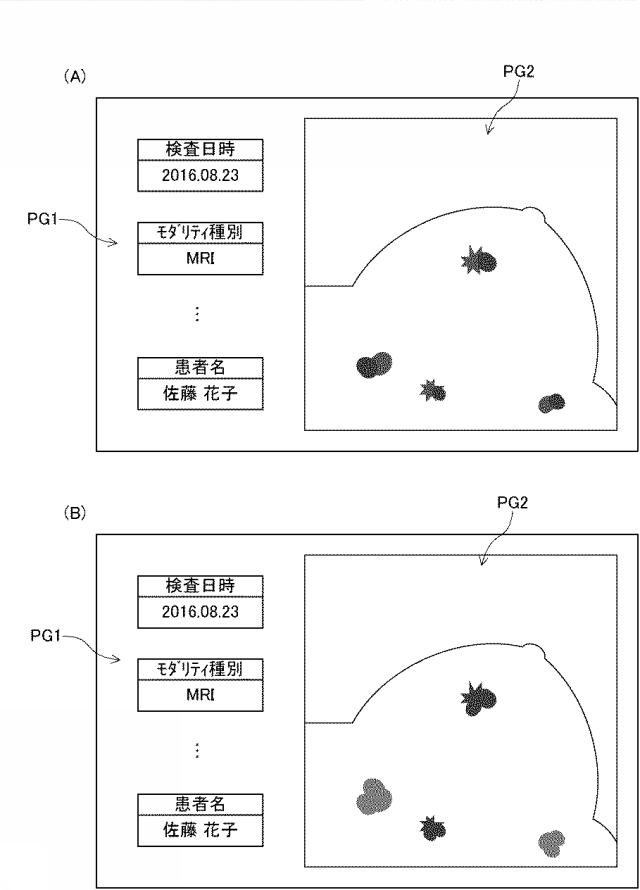 6859572-医用画像表示装置、医用画像表示方法、および医用画像表示プログラム 図000006