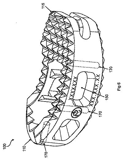 5683026-自己ピボット式脊椎インプラント及び関連器具 図000007