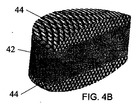 5726536-多孔質生体適合性ポリマー材料および方法 図000007