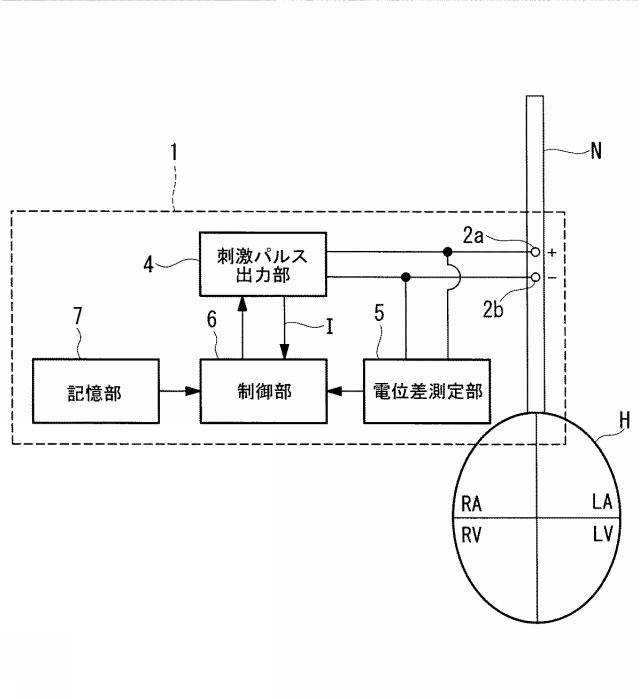 5775678-神経刺激装置 図000007