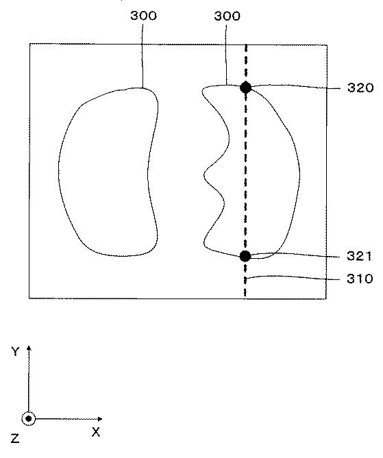 5835881-医用画像処理装置、及び医用画像処理プログラム 図000007