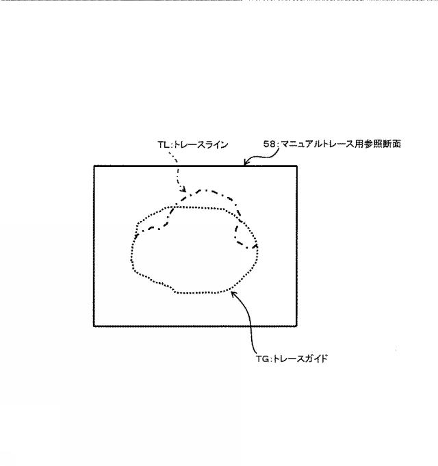 5841771-超音波データ処理装置 図000007