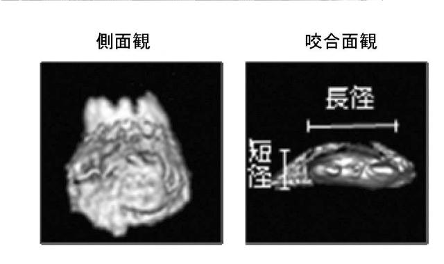 5868844-再生歯ユニットの製造方法 図000007