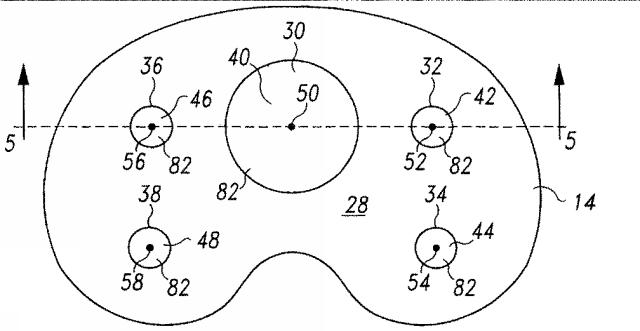 5916989-異なる質感を有する表面を備えた人工関節及びその人工関節の作製方法 図000007