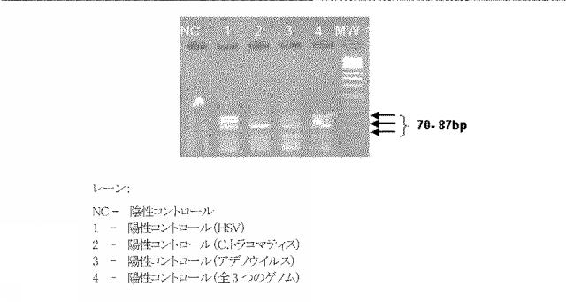 5927243-眼および中枢神経系の細菌、真菌、寄生虫およびウイルス感染の同時検出と識別のための新規な方法 図000007