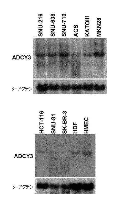 6005272-胃癌診断及び治療のためのＡＤＣＹ３の用途 図000007