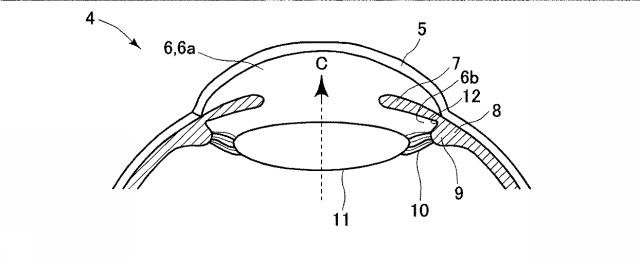 6023378-眼内レンズ及び眼内レンズのハプティック 図000007