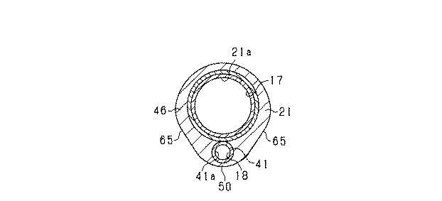 6039199-カテーテル 図000007