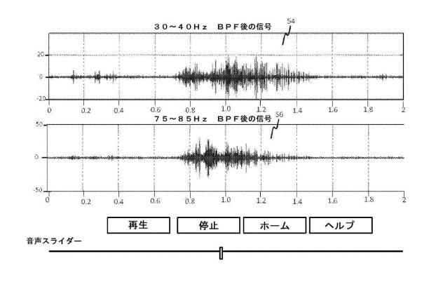 6505708-データ統合インターフェースならびに筋電図記録データおよび音声データを検討する方法 図000007