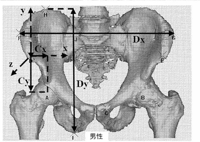 6525582-股関節の面再建 図000007