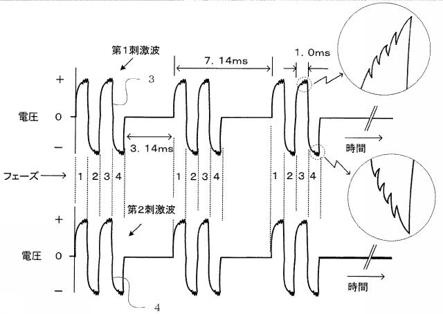 6573268-複合波治療器 図000007