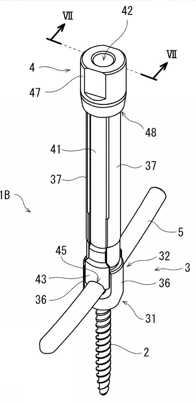 6662891-脊椎固定用保持具およびそれを備えた脊椎固定システム 図000007