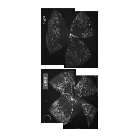 6706367-血管漏出症候群および癌を治療する方法 図000007