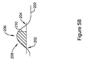 6764956-再同期ペーシング管理に皮下で感知されたＰ波を使用する心臓治療法システム 図000007