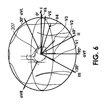 6788279-内部ＥＣＧ取得のためのシステム及び方法 図000007