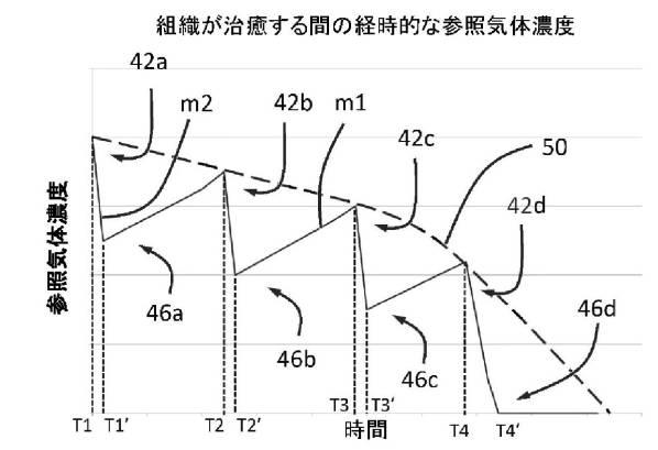 6791559-胸腔ドレナージシステム 図000007