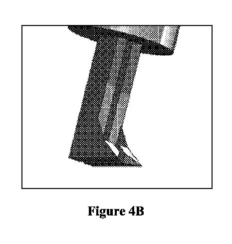 6815416-眼科ナイフ及び使用方法 図000007