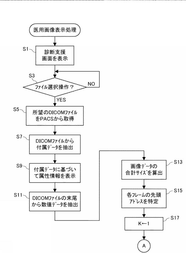 6859572-医用画像表示装置、医用画像表示方法、および医用画像表示プログラム 図000007