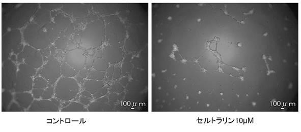 6952980-血管新生阻害薬 図000007