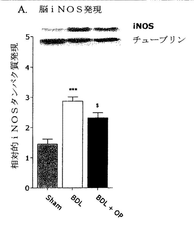 5749255-Ｌ−オルニチンフェニル酢酸塩を用いる門脈圧亢進の治療及び肝機能の修復 図000008