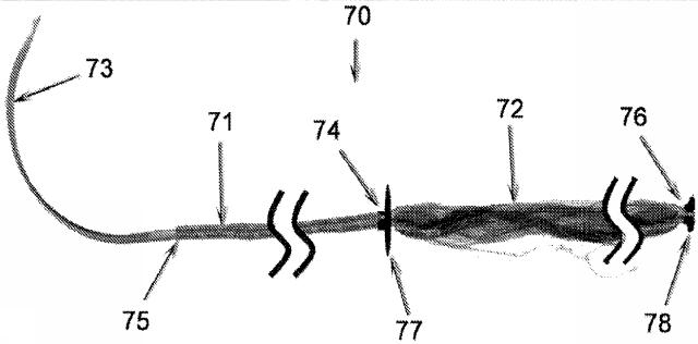 5763535-幹細胞または他の生理活性材料が組み込まれた外科手術用縫合糸 図000008