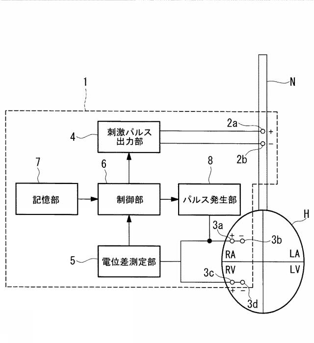 5775678-神経刺激装置 図000008