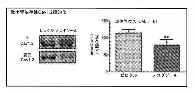 5802197-心血管疾患における予後診断マーカーとしてのＢＩＮ１ 図000008