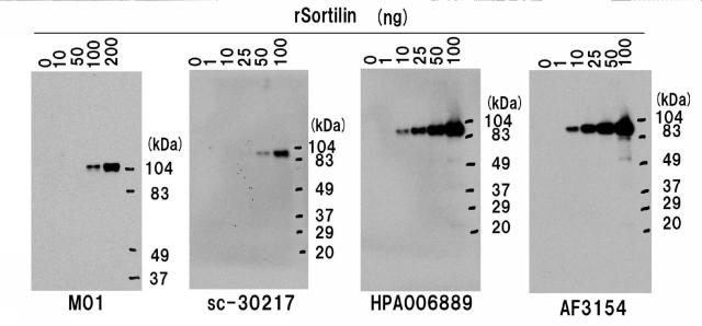 5852433-ソルチリンによる動脈硬化の判定方法 図000008