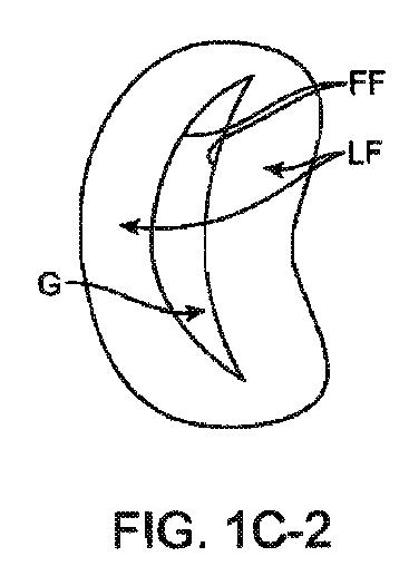 5872692-人工治療装置 図000008