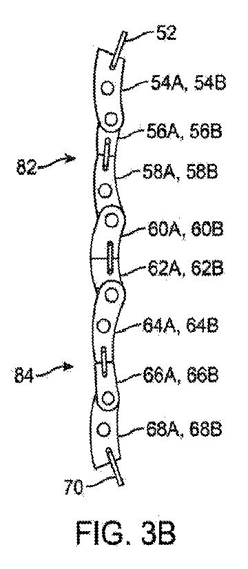 6010545-僧帽弁の修復および置換のためのシステム 図000008