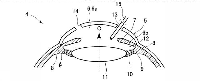 6023378-眼内レンズ及び眼内レンズのハプティック 図000008