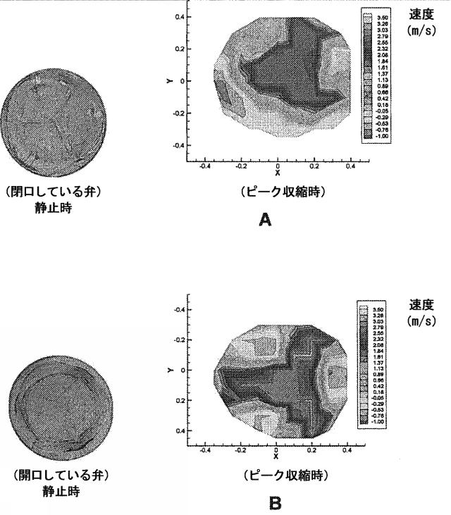 6038018-流れに最適化したポリマー心臓弁 図000008