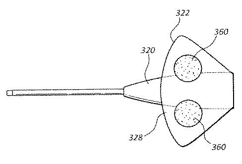 6162141-自動剥離ライナを備える接着剤で裏打ちされたＩＶカテーテル 図000008