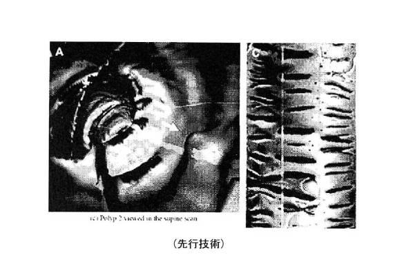 6396310-第一レンダリング投影と第二レンダリング投影との間のトランジションをユーザーに表示するための方法および装置 図000008